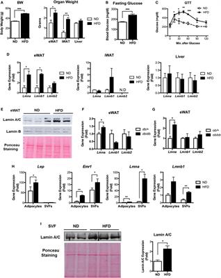 Macrophage Lamin A/C Regulates Inflammation and the Development of Obesity-Induced Insulin Resistance